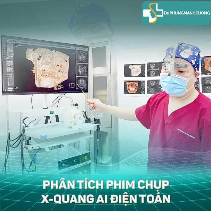 Thực hiện Gọt hàm tại BS Cường sẽ được Chụp X-Quang AI điện toán