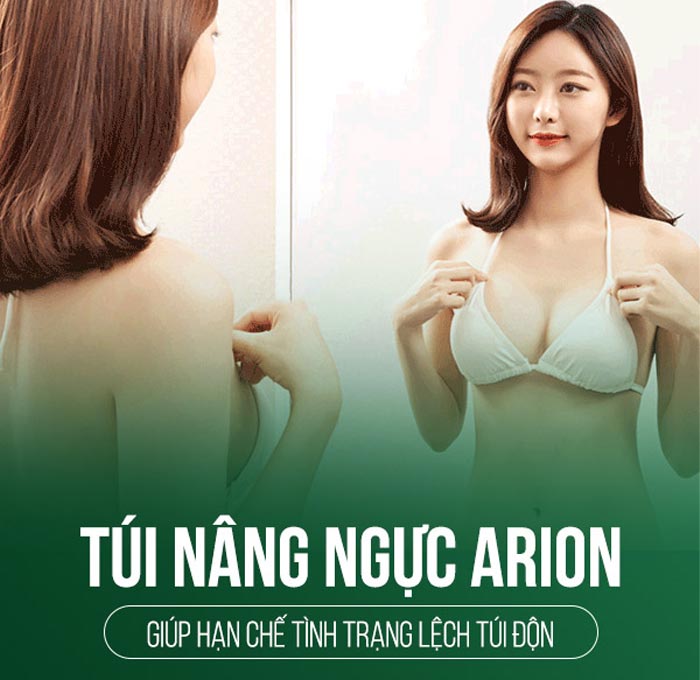 Bí kíp nâng ngực túi Arion giúp cải thiện vòng 1 hiệu quả 6 Nâng ngực túi Arion