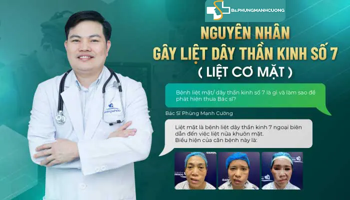 Các nguyên nhân gây ra liệt dây thần kinh số 7