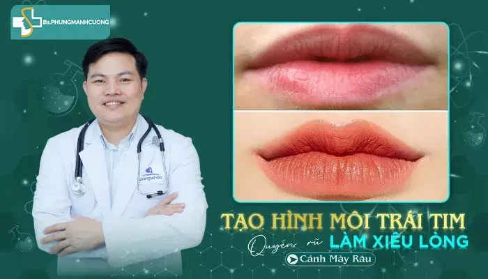 Cắt môi trái tim: Giải pháp cho đôi môi quyến rũ và gợi cảm 7 tạo hình môi trái tim