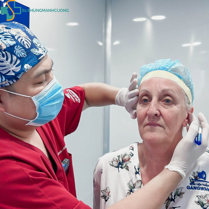 phương pháp căng chỉ collagen