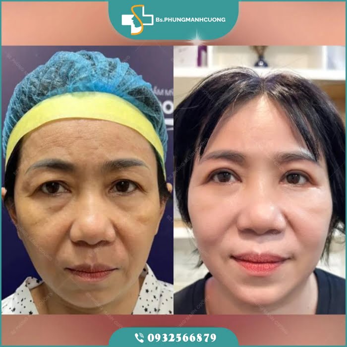 cat mi duoi perfect3