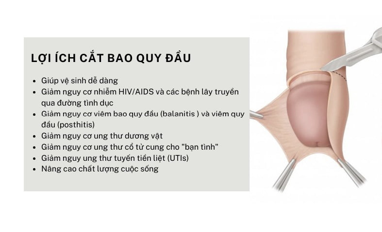 Điều Gì Ẩn Sau Quyết Định Cắt Bao Quy Đầu Của Hàng Triệu Nam Giới? 19 cắt bao quy đầu