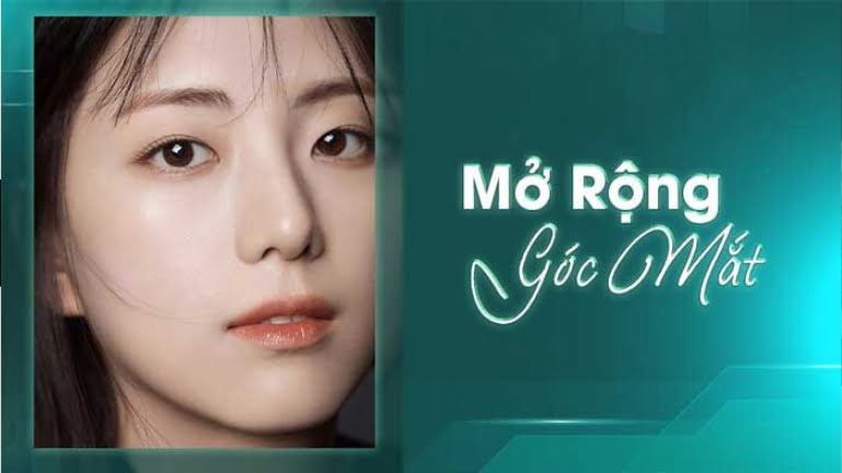 Bí quyết sở hữu đôi mắt to tròn nhờ phẫu thuật mở rộng góc mắt 6 Phẫu thuật mở rộng góc mắt