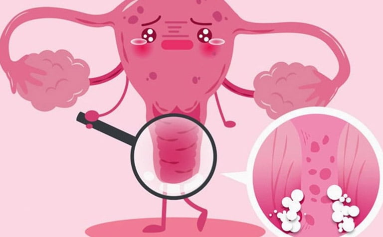 Thẩm Mỹ Vùng Kín Có Nguy Hiểm Không? Tìm Hiểu Chi Tiết Để Đảm Bảo An Toàn 12 thẩm mỹ vùng kín có nguy hiểm không