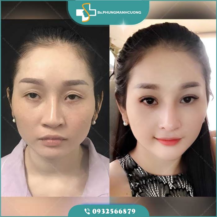 sua mi hong2