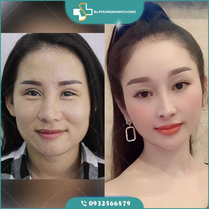 sua mi hong5