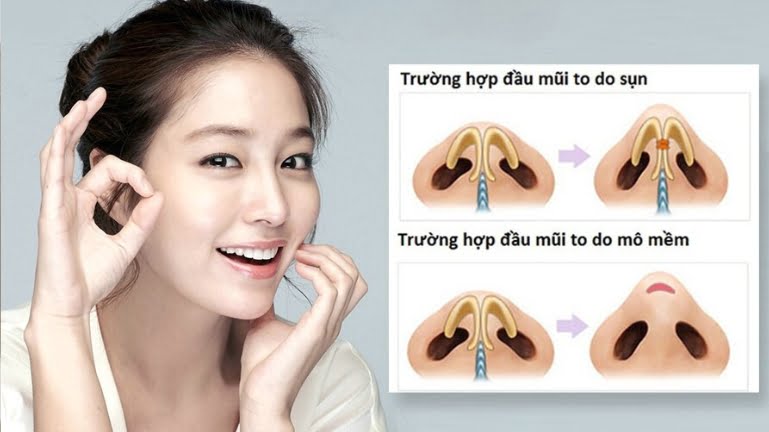 thu nho dau mui 2