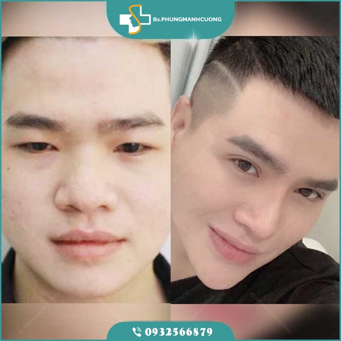 thu nho dau mui4