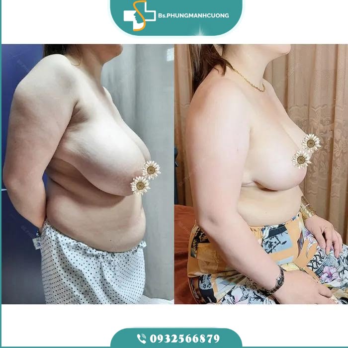 thu nho nguc phi dai4