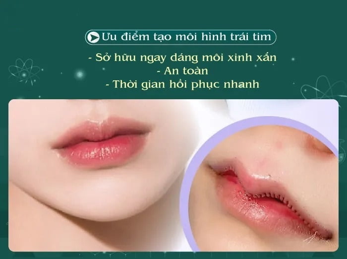 Bí quyết tạo hình môi trái tim đẹp tự nhiên, cuốn hút 6 tại hình môi trái tim