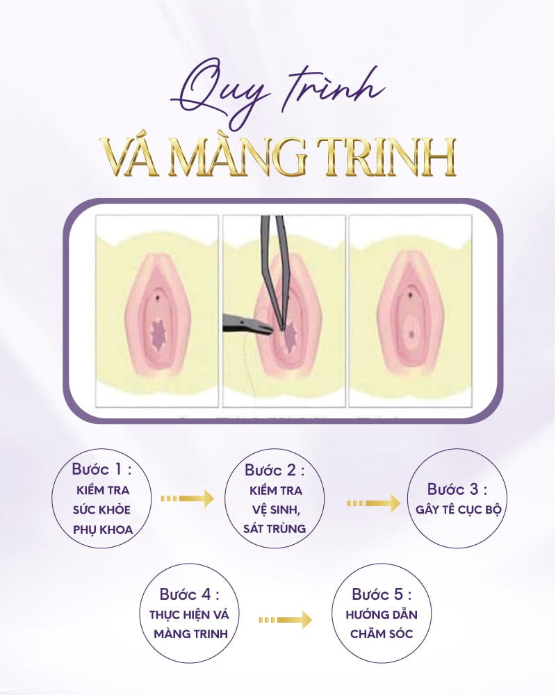Chuyên Gia Chia Sẻ Bí Quyết Khôi Phục Màng Trinh An Toàn 7 vá màng trinh