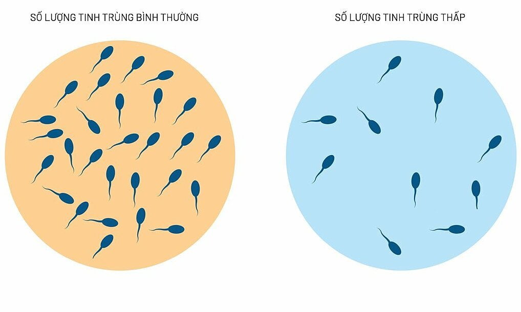 xuất tinh sớm có vô sinh không