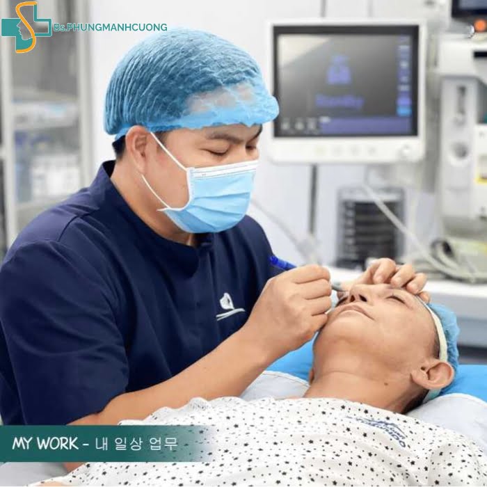 cắt mí có bị sụp mí không