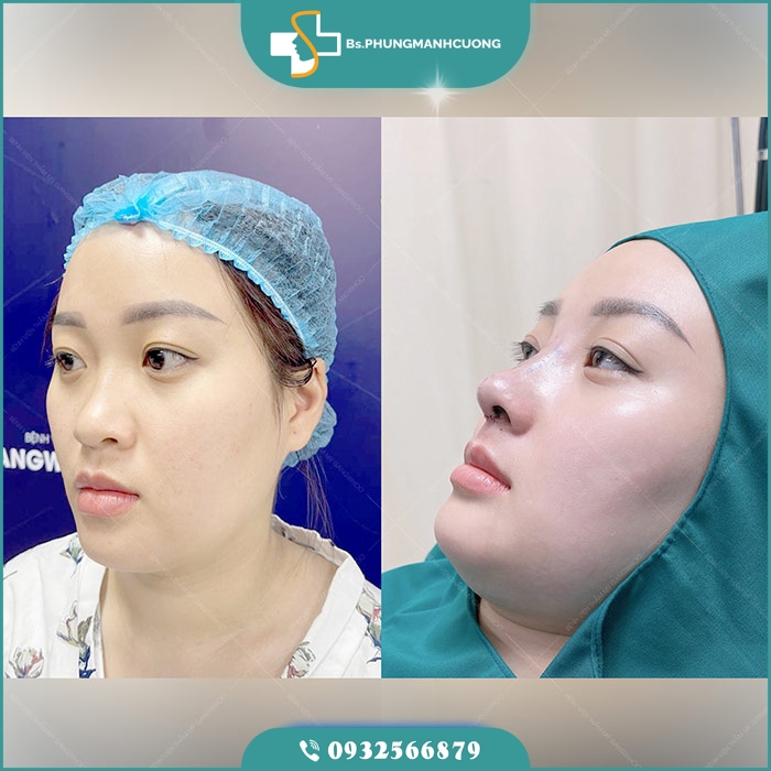 nang mui sun suon5