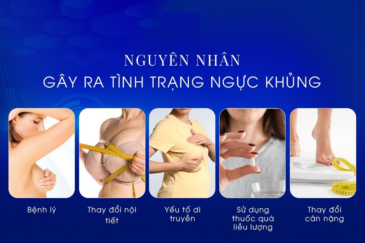 ngực phì đại