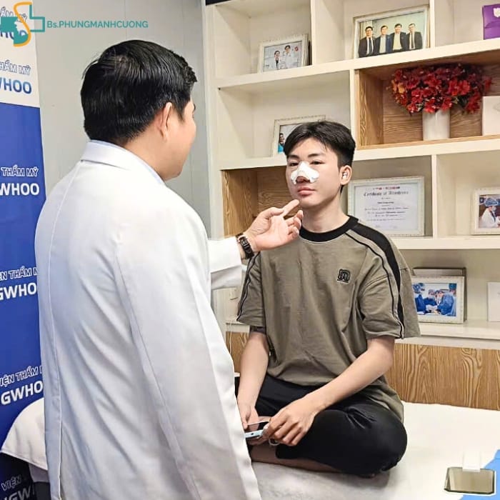 nâng mũi có được cúi đầu không