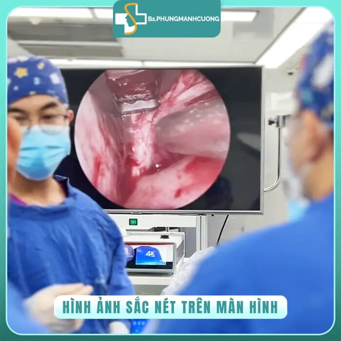 công nghệ nội soi 4k