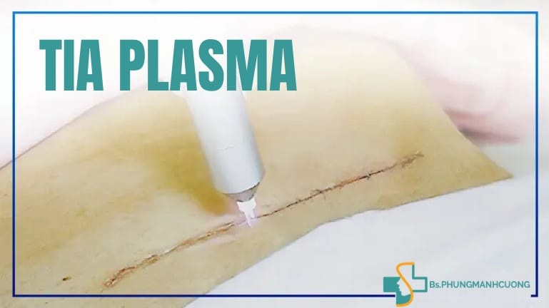 công nghệ plasma