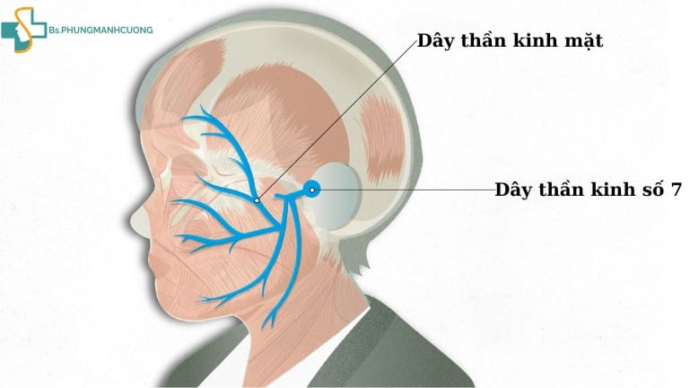 Nguyên nhân gây liệt dây thần kinh số 7 và cách nhận biết 6 nguyên nhân gây liệt dây thần kinh số 7