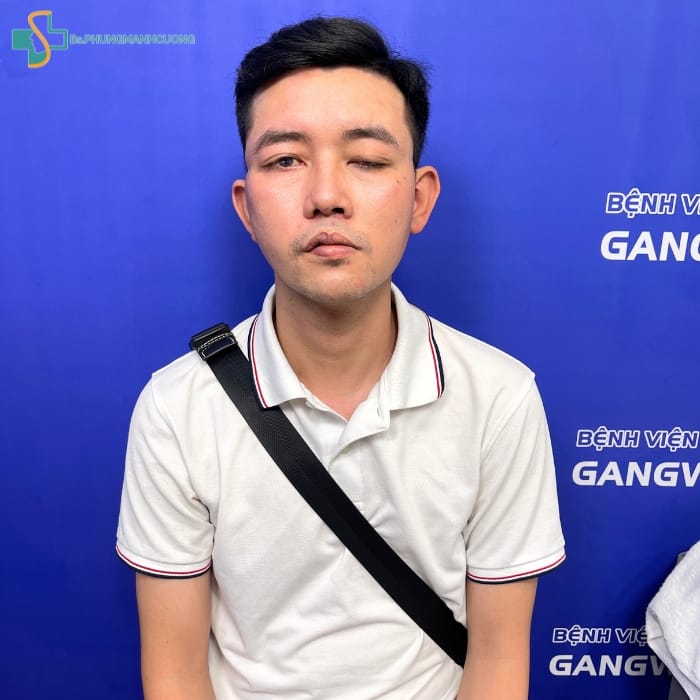 liệt dây thần kinh số 7 có khỏi được không