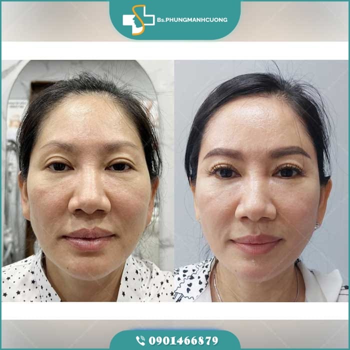 silicon lỏng là gì