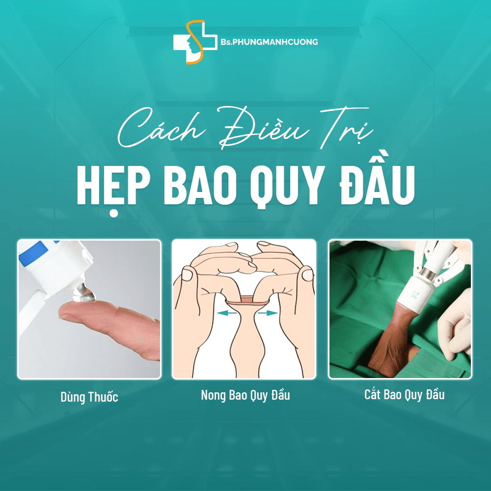 Nhận Biết Sớm Hẹp Bao Quy Đầu Qua Các Triệu Chứng Thường Gặp 11 hẹp bao quy đầu