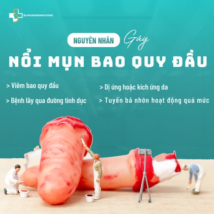 thuốc bôi trị mụn bao quy đầu
