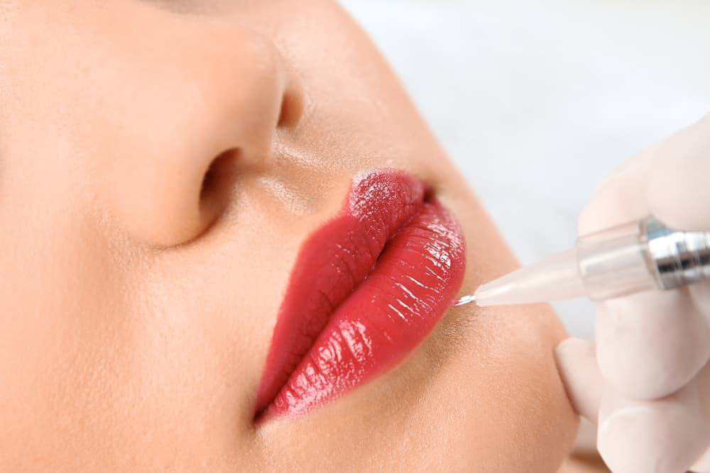 Tiêm filler môi có đau không? Tìm hiểu chi tiết về trải nghiệm và cách giảm đau 5 Tiêm filler môi có đau không?