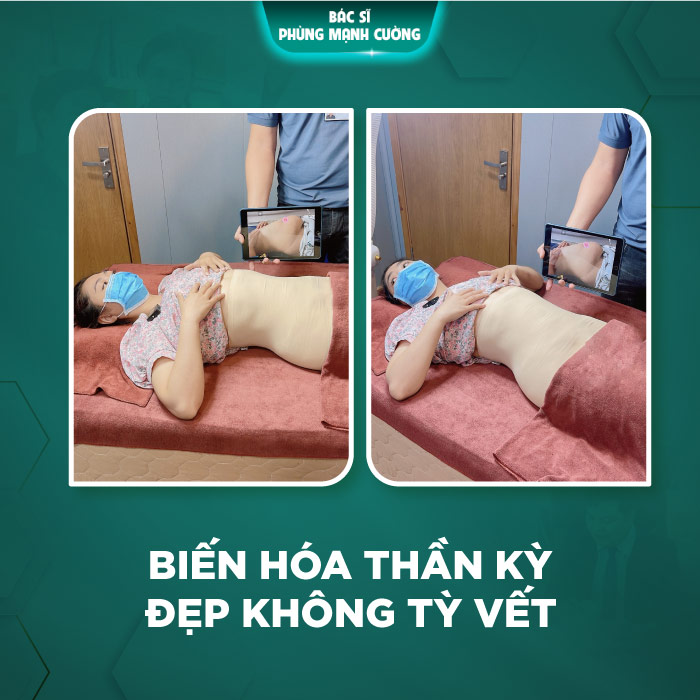 Giảm mỡ eo là gì? Hành trình sở hữu vòng eo thon gọn 7 hanh trinh lam dep 8