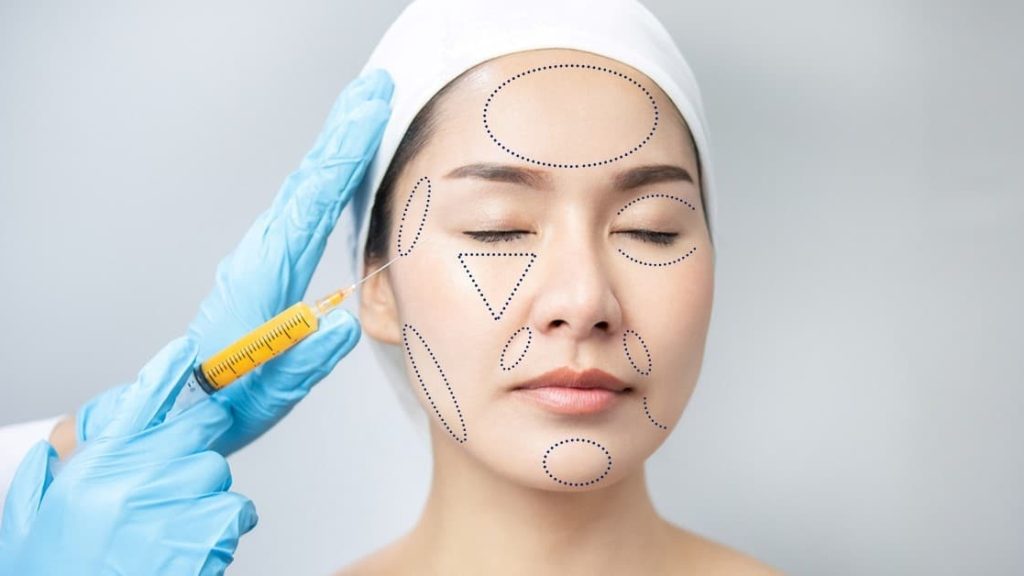 Vì sao cấy mỡ mặt ngày càng được ưa chuộng trong thẩm mỹ? 6 Cấy mỡ mặt