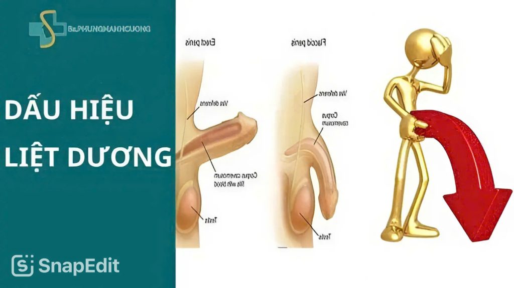 Bệnh liệt dương có nguy hiểm không? Cách chữa trị kịp thời 7 z6675036162440 a0d03e5652c57c4835b665e8ef8bdcc9