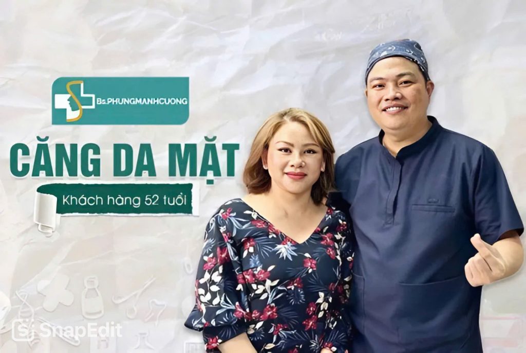 Căng da mặt bằng chỉ collagen: Phương pháp trẻ hóa da an toàn 7 Căng da mặt bằng chỉ collagen