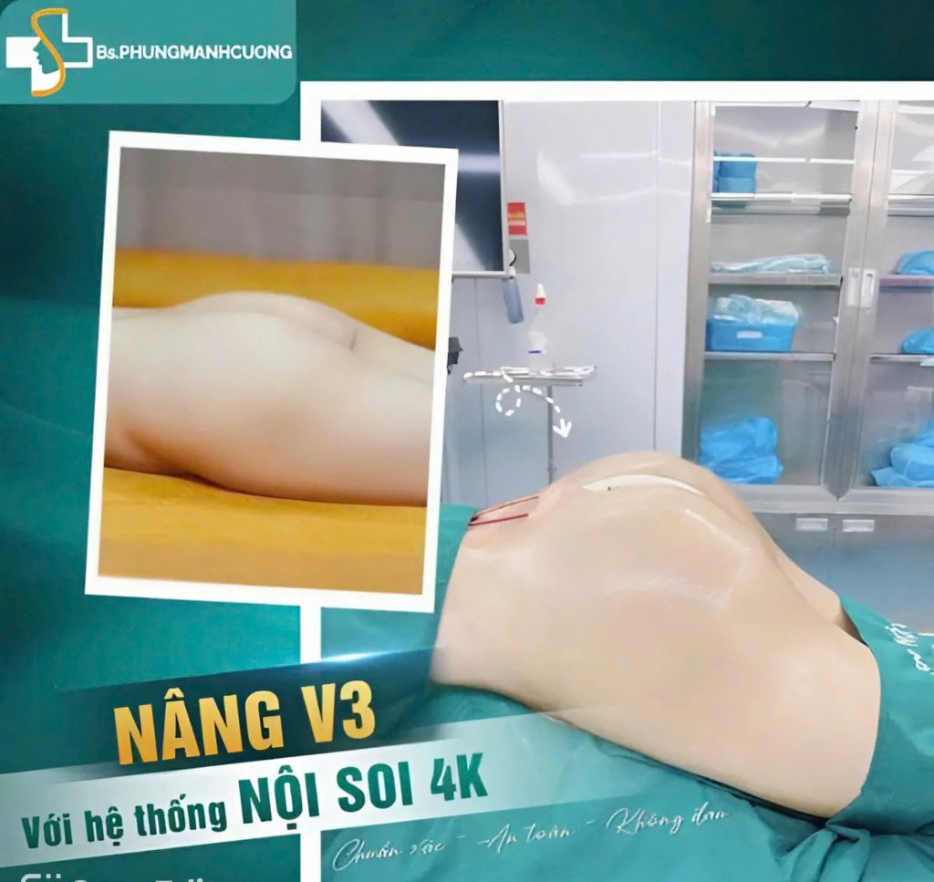 Nâng mông có đau không? Giải đáp chi tiết từ chuyên gia 5 Nâng mông có đau không