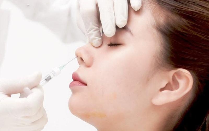 Tiêm Filler Mũi Là Gì? Hiểu Biết và Lựa Chọn An Toàn 5 Tiêm filler mũi là gì?