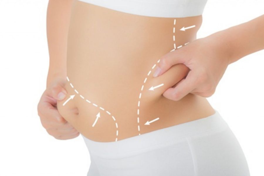 Có nên giảm mỡ eo? Những điều bạn cần biết trước khi bắt đầu 5 Có nên giảm mỡ eo?