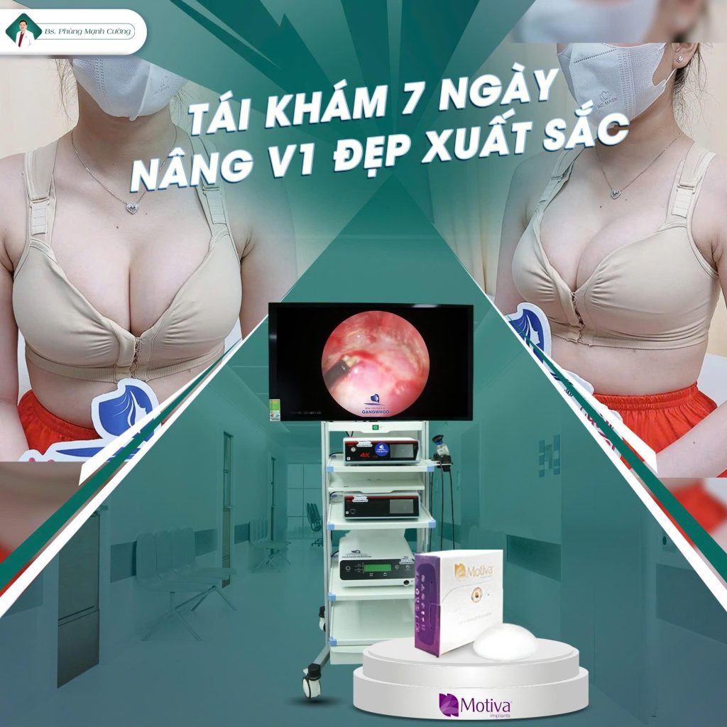 Có nên nâng ngực nội soi hay không? Những điều cần biết 5 Có Nên Nâng Ngực Nội Soi Hay Không