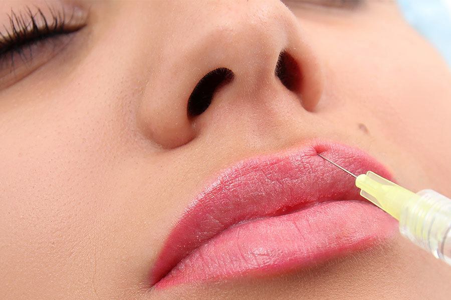 Tiêm Filler Môi Không Đau: Sự thật và cách thực hiện 5 tiêm filler môi không đau