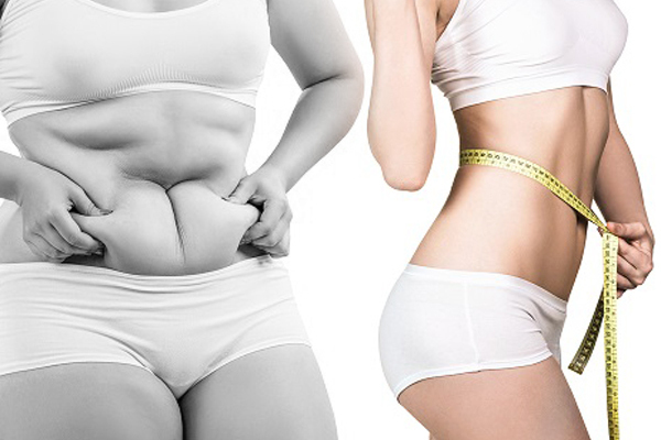 Hút mỡ bụng an toàn: Những điều bạn cần biết 5 Hút mỡ bụng an toàn là gì?