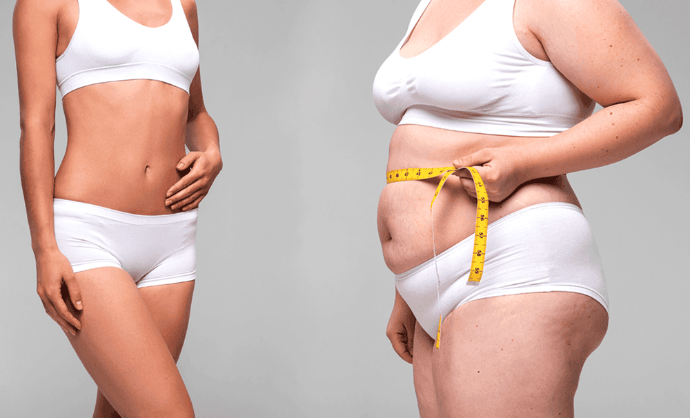 Giảm Béo Lipo Ultrasound Là Gì? Cơ Chế Khoa Học Phía Sau Công Nghệ 5 giảm béo Lipo Ultrasound