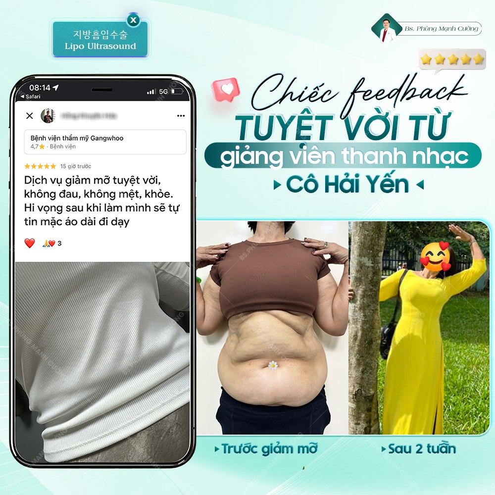Lipo Ultrasound là gì? – Công nghệ hút mỡ siêu âm chuẩn y khoa 8 Khách hàng phản hồi sau thực hiện hút mỡ lipo ultrasound