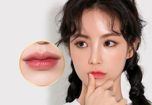 Phẫu thuật thu mỏng môi: Giải pháp cho đôi môi cân đối và hài hòa 7 tham my moi danh thanh moi mong nhu the nao 3