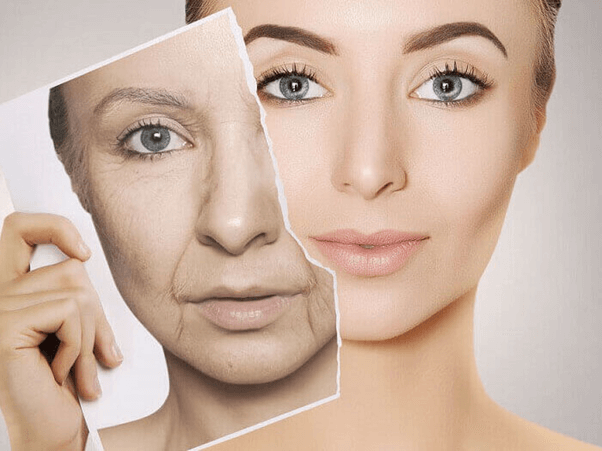 Căng da mặt bằng chỉ là gì? Giải đáp chi tiết 6 uu diem cua cang chi collagen
