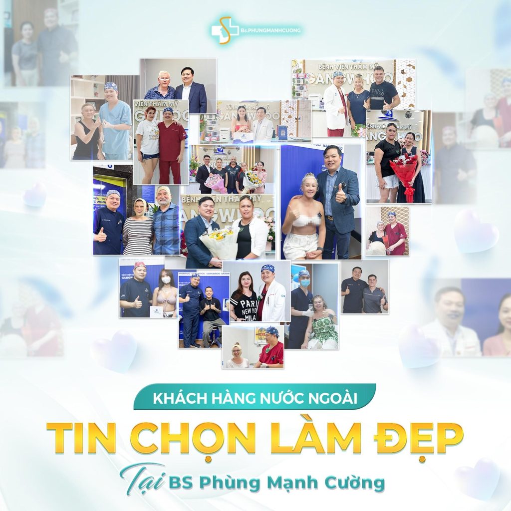 Căng Da Mặt Nội Soi Có Tốt Không – Giải Pháp Trẻ Hóa Thế Hệ Mới 7 Căng Da Mặt Nội Soi Tại BS Phùng Mạnh Cường