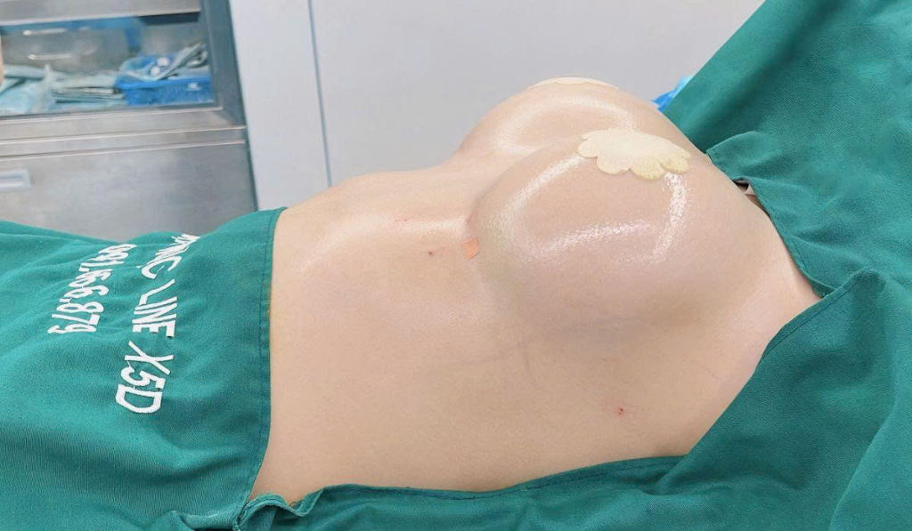 Nâng ngực đẹp: Bí quyết sở hữu vòng 1 hoàn hảo và an toàn 5 Thế nào là một bộ ngực đẹp sau nâng?