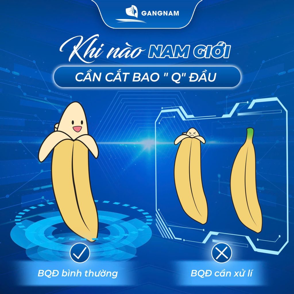 Làm Thế Nào Để Tìm Địa Chỉ Cắt Bao Quy Đầu Thẩm Mỹ Uy Tín? 5 địa chỉ cắt bao quy đầu thẩm mỹ uy tín