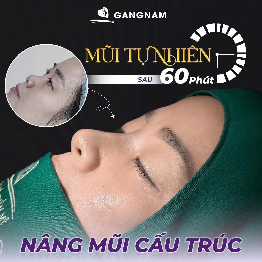 Sự Thật Về Việc Nâng Mũi Có Ảnh Hưởng Đến Mắt Không – Chuyên Gia Giải Đáp Chi Tiết 6 Khi Nào Nâng Mũi Thật Sự Có Nguy Cơ Ảnh Hưởng Đến Mắt?